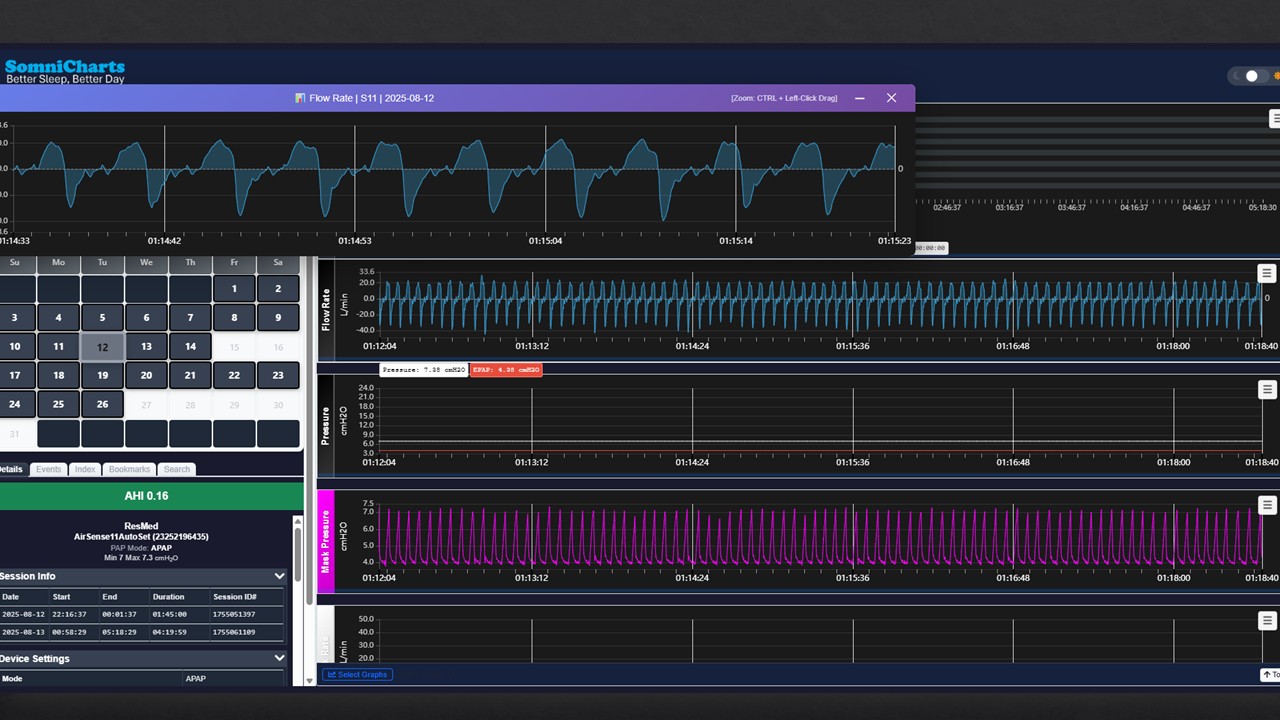 SomniWave — Waveform Analysis