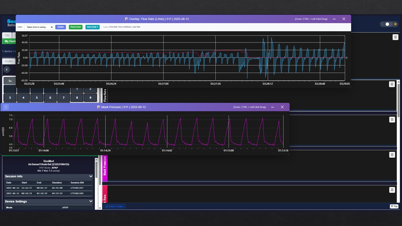 SomniShare — Multi-Profile